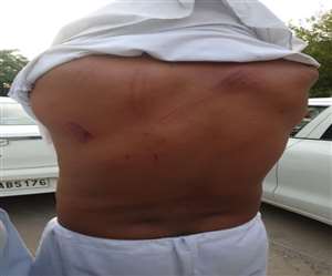 कृषि कानून के विरोध में बैठे आंदोलनकारियों ने ग्रामीण पर किया जानलेवा हमला