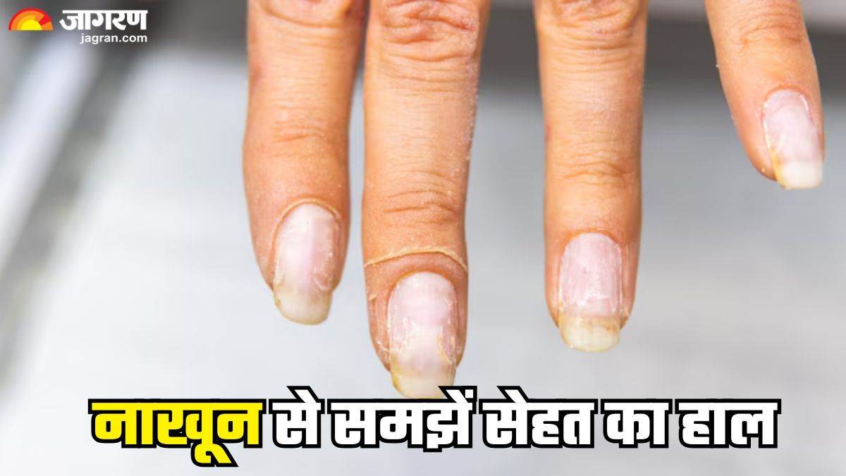 https://www.jagranimages.com/images/newimg/13062025/13_06_2025-nail_health_condition_23962706_1296106.jpg