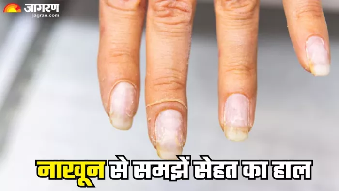 नाखून से समझें अपनी सेहत का हाल (Picture Credit- Freepik)