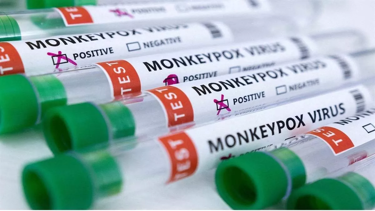Monkeypox isn't Gay Disease: कलंक के डर से लोग नहीं करवा रहे टेस्ट, WHO की बड़ी चेतावनी