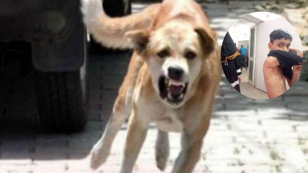 https://www.jagranimages.com/images/newimg/13092025/13_09_2025-dog_bite_pilibhit_24045393.jpg