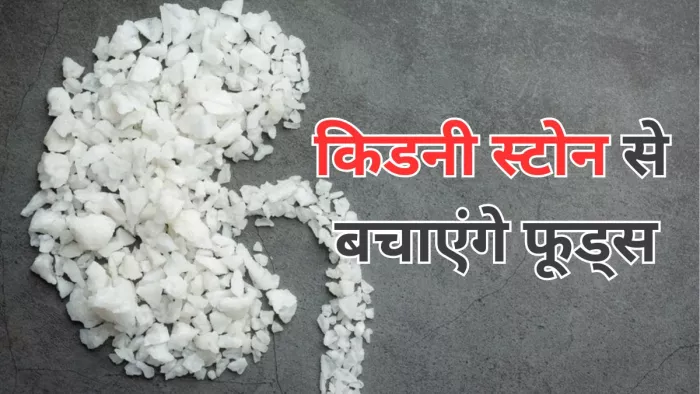 किडनी स्टोन से बचने के लिए खाएं ये फूड्स