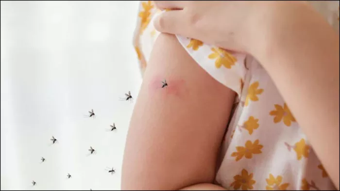 Zika Virus Symptoms: जानें कैसे होते हैं ज़ीका वायरस के लक्षण