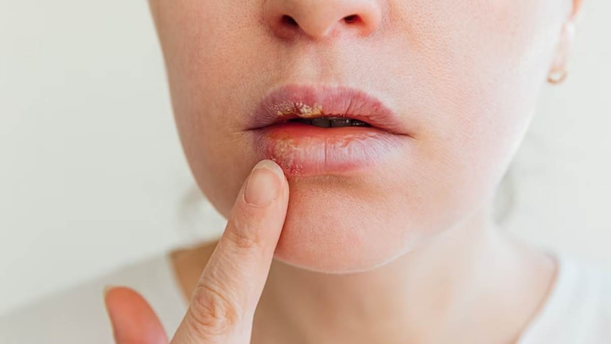 winter beauty care follow these home remedies to take care of your lips in winters