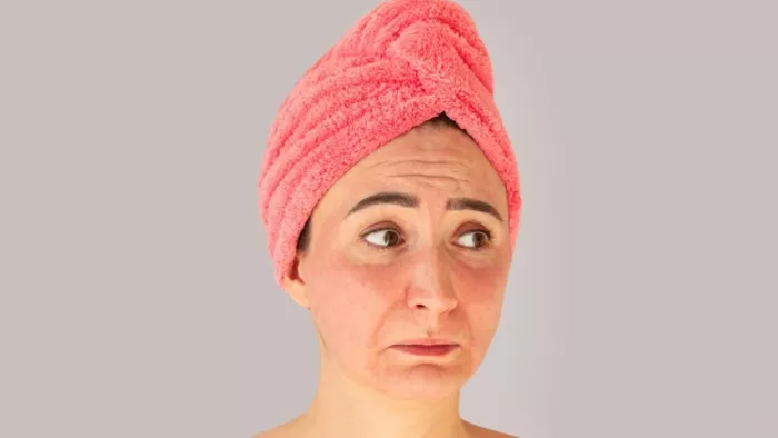 How to Reduce Face Redness: चेहरे पर होने वाली जलन और रेडनेस को इन तरीकों से कर सकते हैं कम