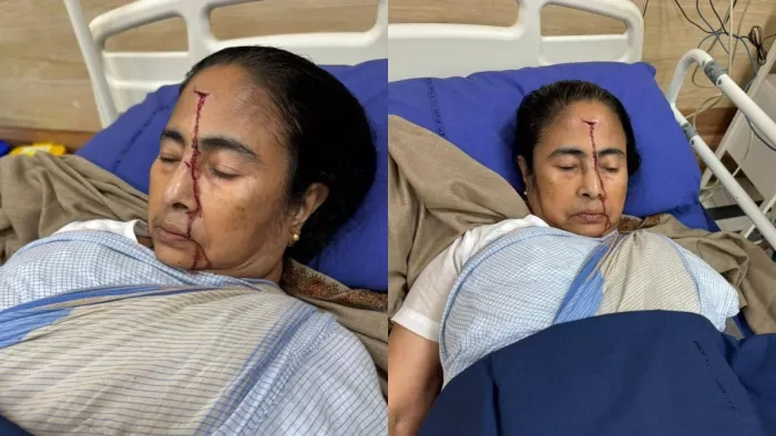 पश्चिम बंगाल की मुख्यमंत्री ममता बनर्जी को लगी गंभीर चोट। फोटोः @AITCofficial