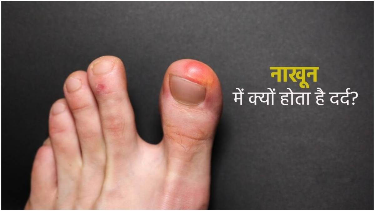 Know the tips to grow stronger and healthier nails-नाखून जल्दी टूट जाते हैं  तो इन 5 उपायों से बनाएं स्ट्रॉन्ग और खूबसूरत | Jansatta