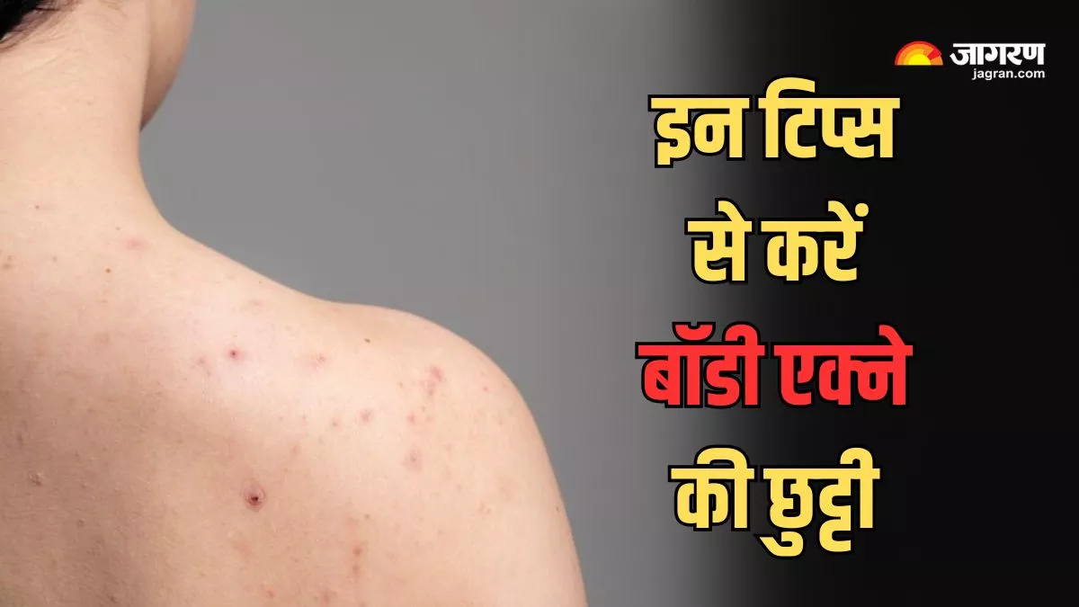 Body Acne: अगर आप भी जूझ रहे हैं बॉडी एक्ने की समस्या से, तो इन टिप्स की मदद से पाएं इनसे निजात