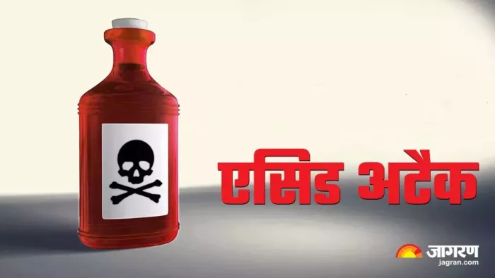 Acid Attack in Uttarakhand: स्वजनों की रिपोर्ट पर पुलिस ने मुकदमा किया दर्ज