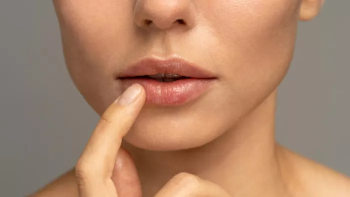 ड्राई लिप्स से बचने के लिए करें ये उपाय।
