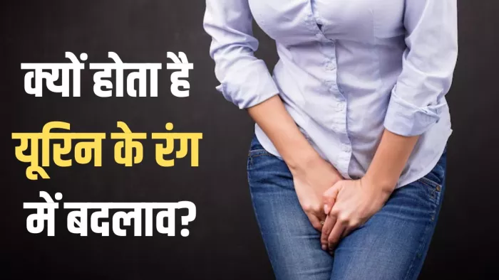 इन वजहों से पीला हो जाता है यूरिन का रंग (Picture Credit- Freepik)