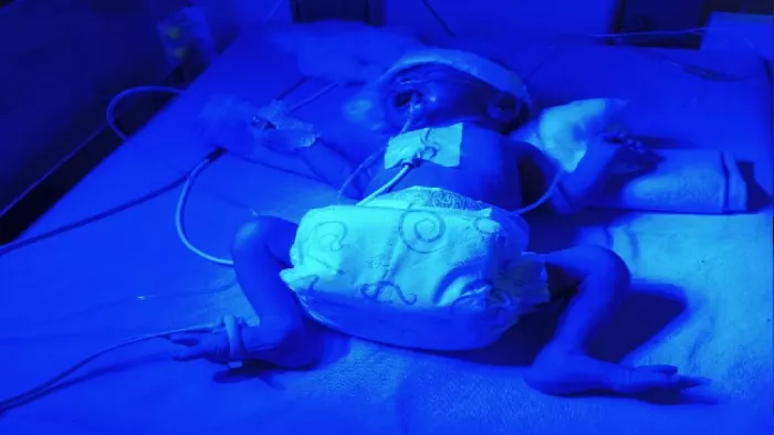 अस्पताल में बच्चे का इलाज चल रहा है।