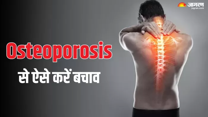 कैसे करें ओस्टियोपोरोसिस से बचाव (Picture Credit- Freepik)