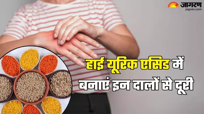 हाई यूरिक एसिड में किन दालों से करें परहेज और किनका करें सेवन (Picture Credit- Freepik)