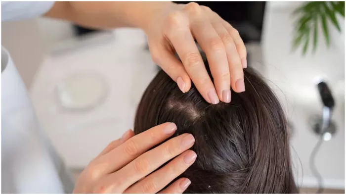 स्कैल्प की देखभाल के लिए अपनाएं ये टिप्स