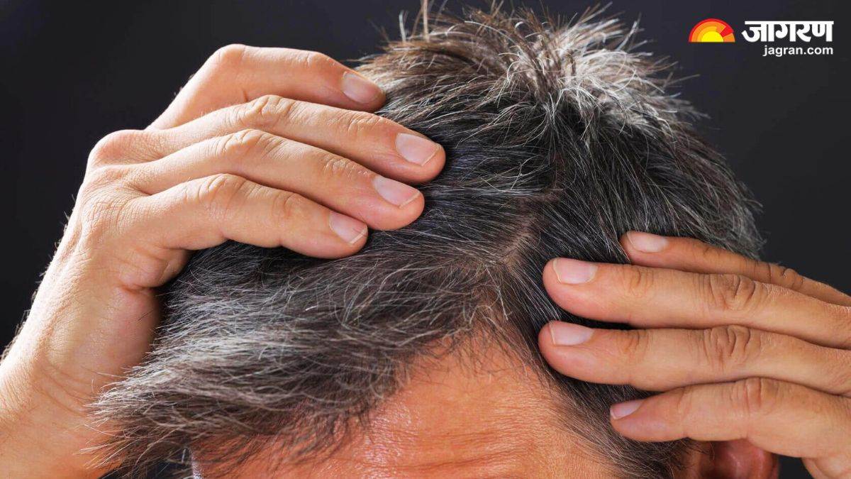 https://www.jagranimages.com/images/newimg/14072024/14_07_2024-premature_greying_remedies_23758494.jpg