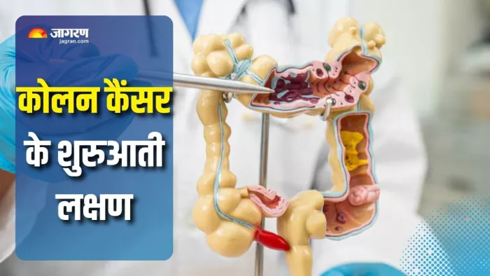 कोलन कैंसर के इन लक्षणों को न करें इग्नोर (Picture Courtesy: Freepik)