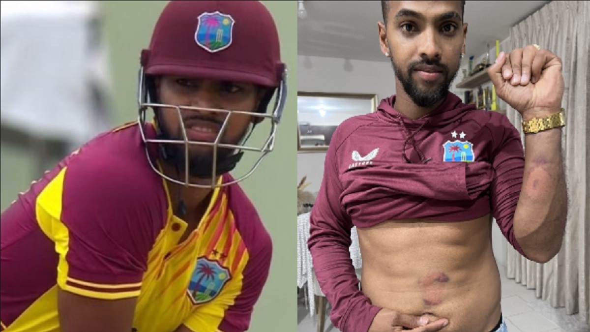 https://www.jagranimages.com/images/newimg/14082023/14_08_2023-nicholas_pooran_injury_23501235.jpg