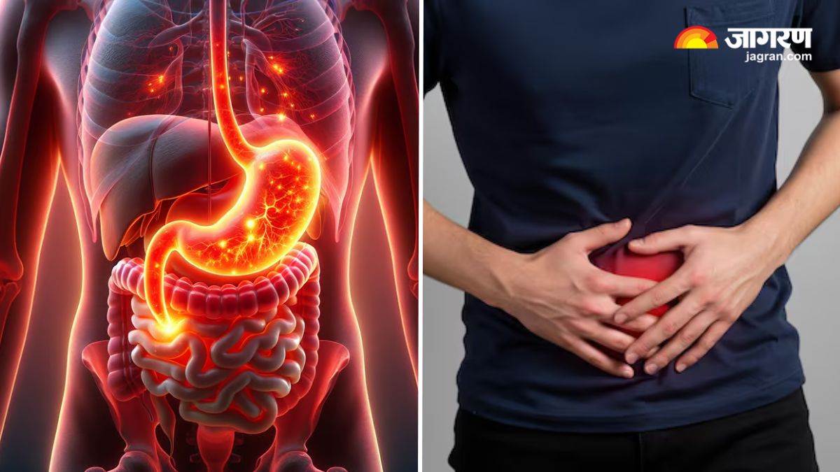 https://www.jagranimages.com/images/newimg/14082025/14_08_2025-stomach_24012922_141442879.jpg