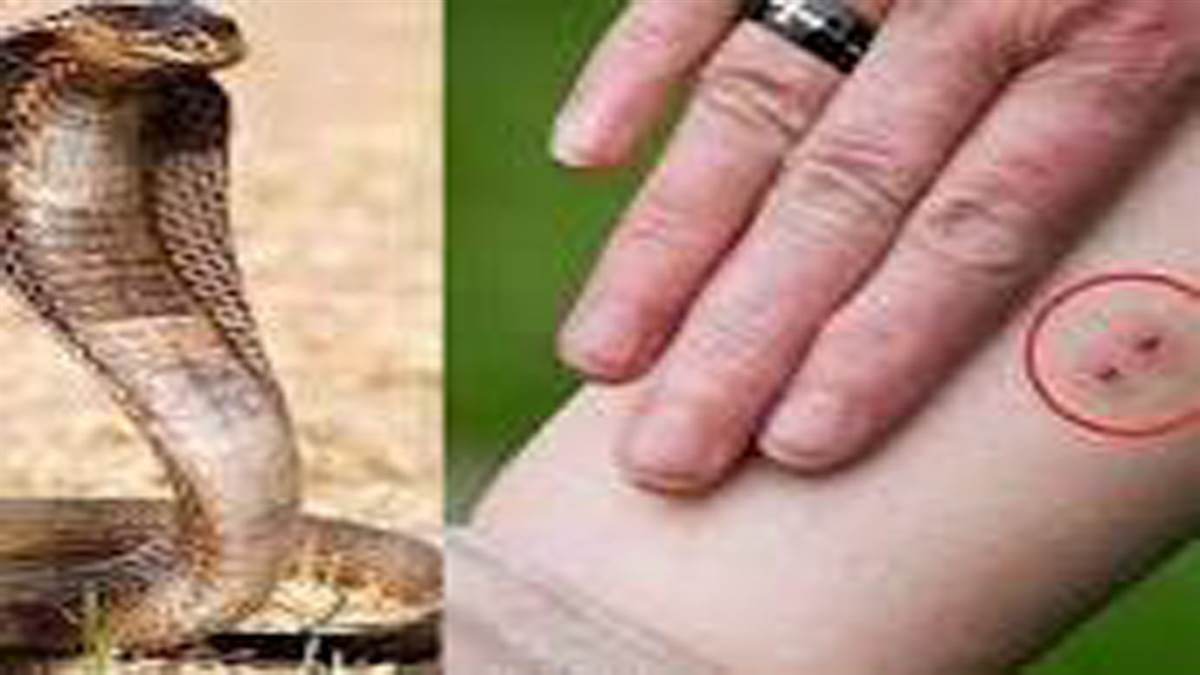 https://www.jagranimages.com/images/newimg/14092022/14_09_2022-snake_bite_23069063.jpg