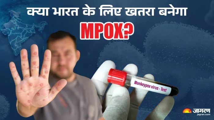 एक्सपर्ट से जानें भारत में मंकीपॉक्स का खतरा, लक्षण और बचाव के उपाय