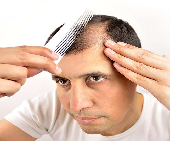 Hair Fall : सिर का गिर रहा बाल तो करें ये तीन उपाय, फिर देखिए...