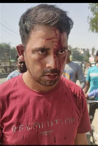 आईटीबीपी जवान को लोहे की राड मारकर जख्मी किया।