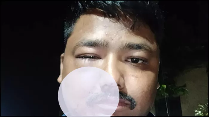 खाने में डिस्काउंट मांगने पर वायुसेना के जवानों को पीटा