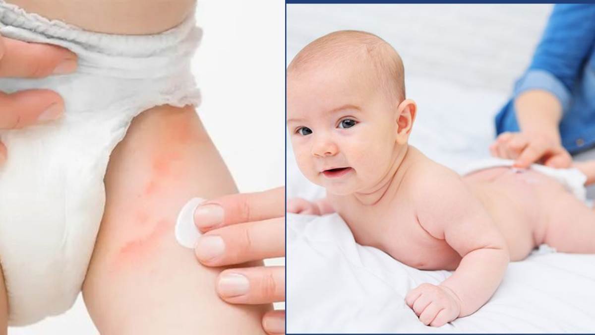 https://www.jagranimages.com/images/newimg/14112024/14_11_2024-diaper-rash-cream-for-babies_23831216.jpg