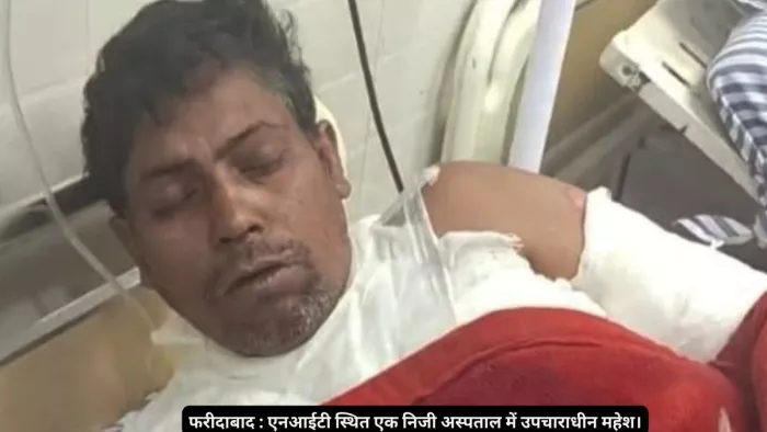 नूंह हिंसा के आरोपी बिट्टू बजरंगी के भाई पर बदमाशों ने पेट्रोल छिड़क कर आग लगाई।
