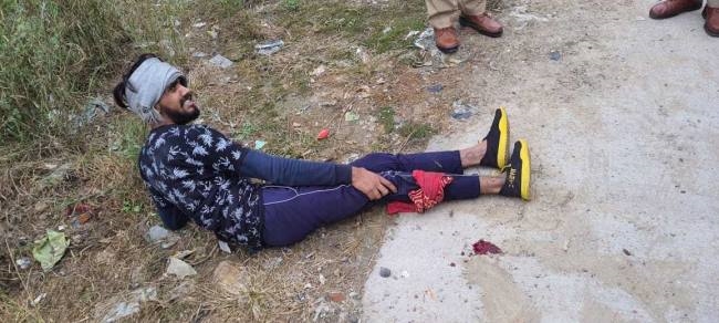 the miscreant who robbed people on morning walk injured in encounter