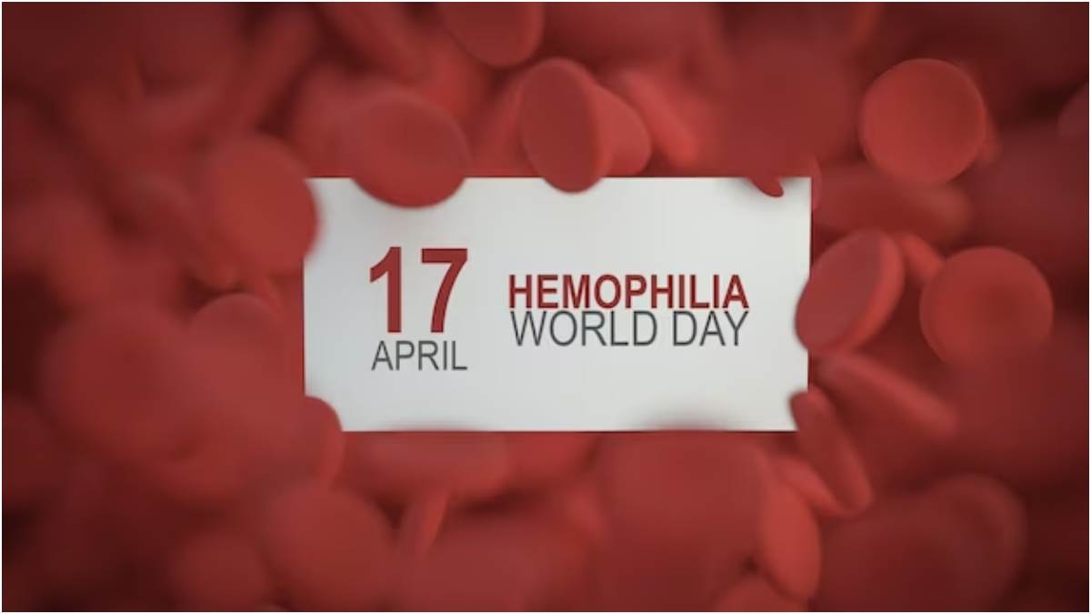 https://www.jagranimages.com/images/newimg/15042023/15_04_2023-world_hemophilia_day_history_23385973.jpg