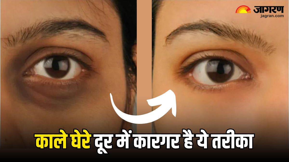 https://www.jagranimages.com/images/newimg/15042024/15_04_2024-how_to_get_rid_of_dark_circles_23697488.jpg