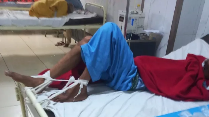 मरीज के बांधने पड़ रहे पैर, जांच टीम ने लिए स्टाफ के बयान