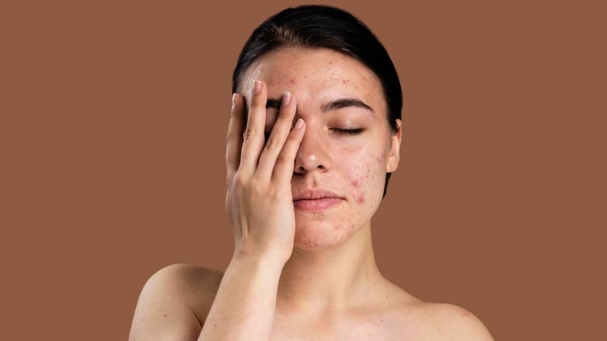 lifestyle skin tells about health know signs in hindi