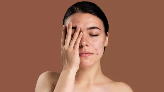 Signs of Sensitive Skin: इन लक्षणों से पहचानें आपकी स्किन सेंसिटिव है या नहीं