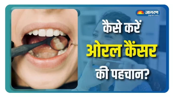 किन वजहों से बढ़ता है ओरल कैंसर का रिस्क? (Picture Courtesy: Freepik)
