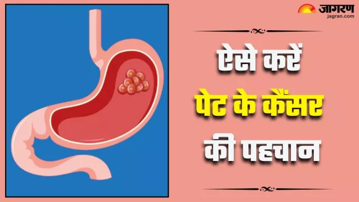 पेट के कैंसर के इन लक्षणों को न करें नजरअंदाज (Picture Credit- Freepik)