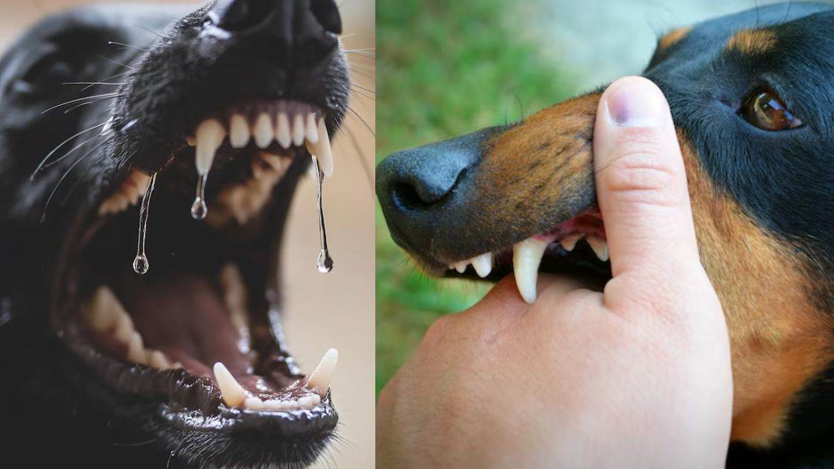 https://www.jagranimages.com/images/newimg/15082025/15_08_2025-dog_bite_rabies_24014078.jpg