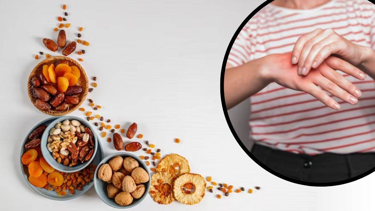 https://www.jagranimages.com/images/newimg/15082025/15_08_2025-dry_fruits_for_uric_acid_24014175.jpg