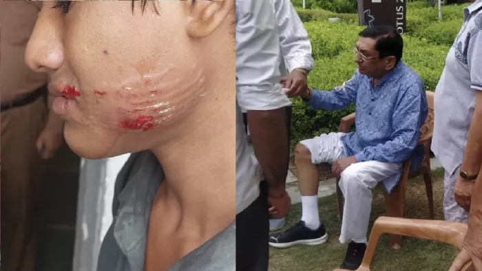 Noida Dog Attack: नोएडा में कुत्तों का आतंक, सोसायटी में दो लोगों को नोंच डाला