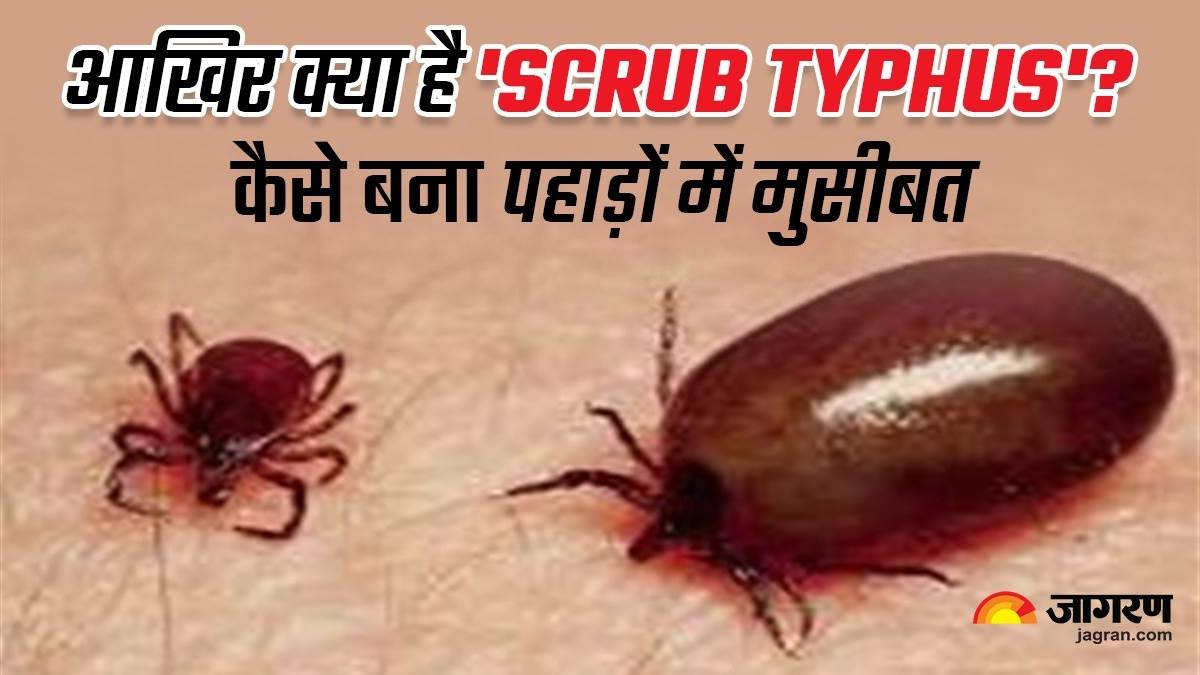 Scrub Typhus हिमाचल में तेजी से पैर पसार रहा 'स्क्रब टाइफस', जानिए