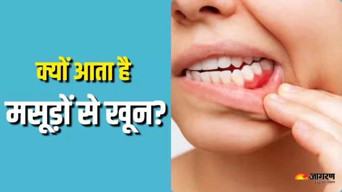 मसूड़ों से खून आने की समस्या को कैसे करें दूर? (Picture Courtesy: Freepik)