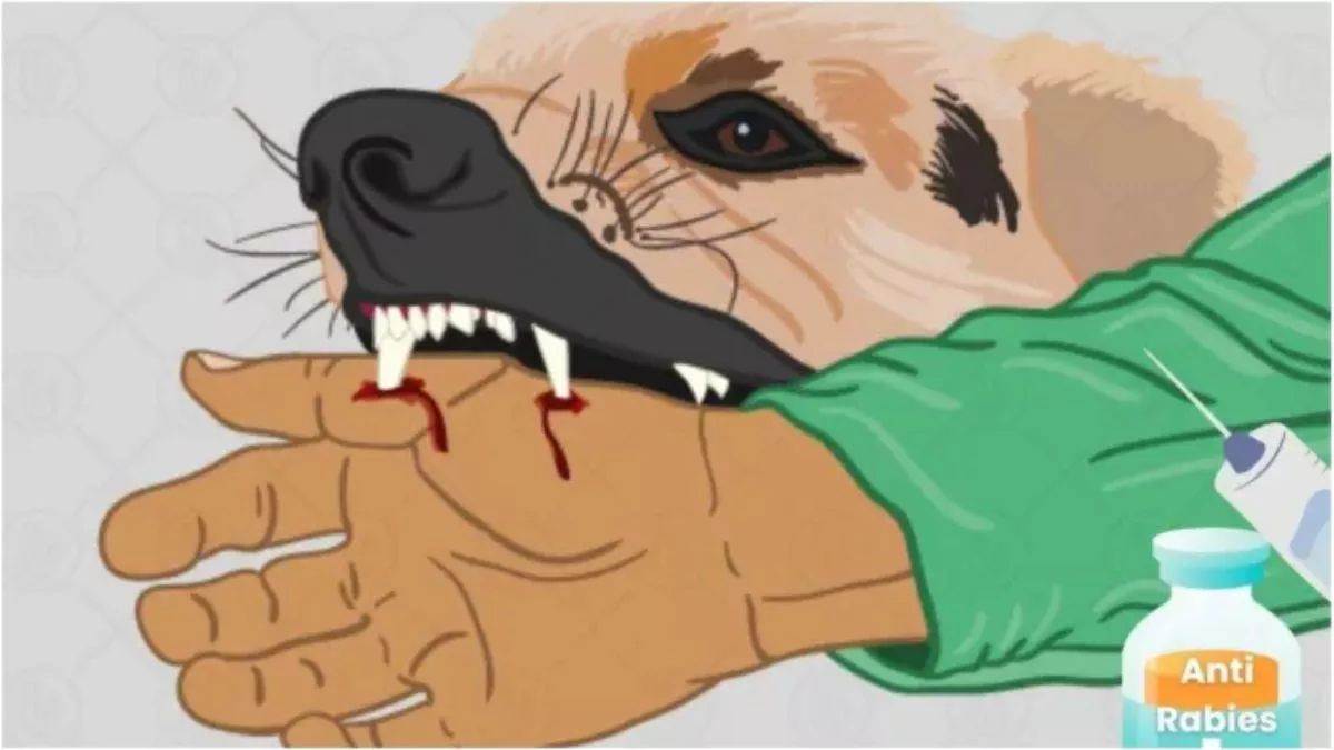 https://www.jagranimages.com/images/newimg/15092025/15_09_2025-rabies_24048224_2135553.jpg