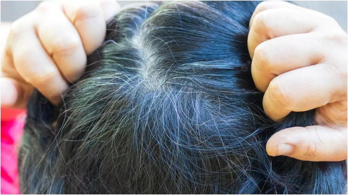 Premature Greying Causes: वक्त से पहले इन 4 कारणों से सफद होने लगते हैं बाल, इससे बचने के तरीके भी जान लें - 4 Reasons Behind Premature Greying Of Hair Know How Premature Greying Causes: वक्त से पहले इन 4 कारणों से सफद होने लगते हैं बाल, इससे बचने के तरीके भी जान लें - 4 Reasons Behind Premature Greying Of Hair Know How