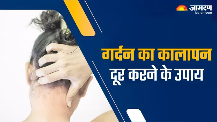 How to Get Rid of a Dark Neck: गर्दन का कालापन दूर करने के उपाय