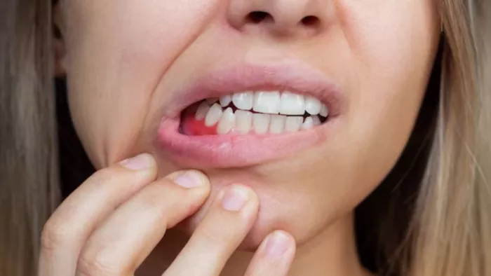 मसूड़ों से खून आने की समस्या से करें बचाव