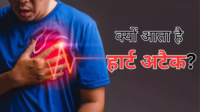 क्या आप जानते हैं हार्ट अटैक का कारण