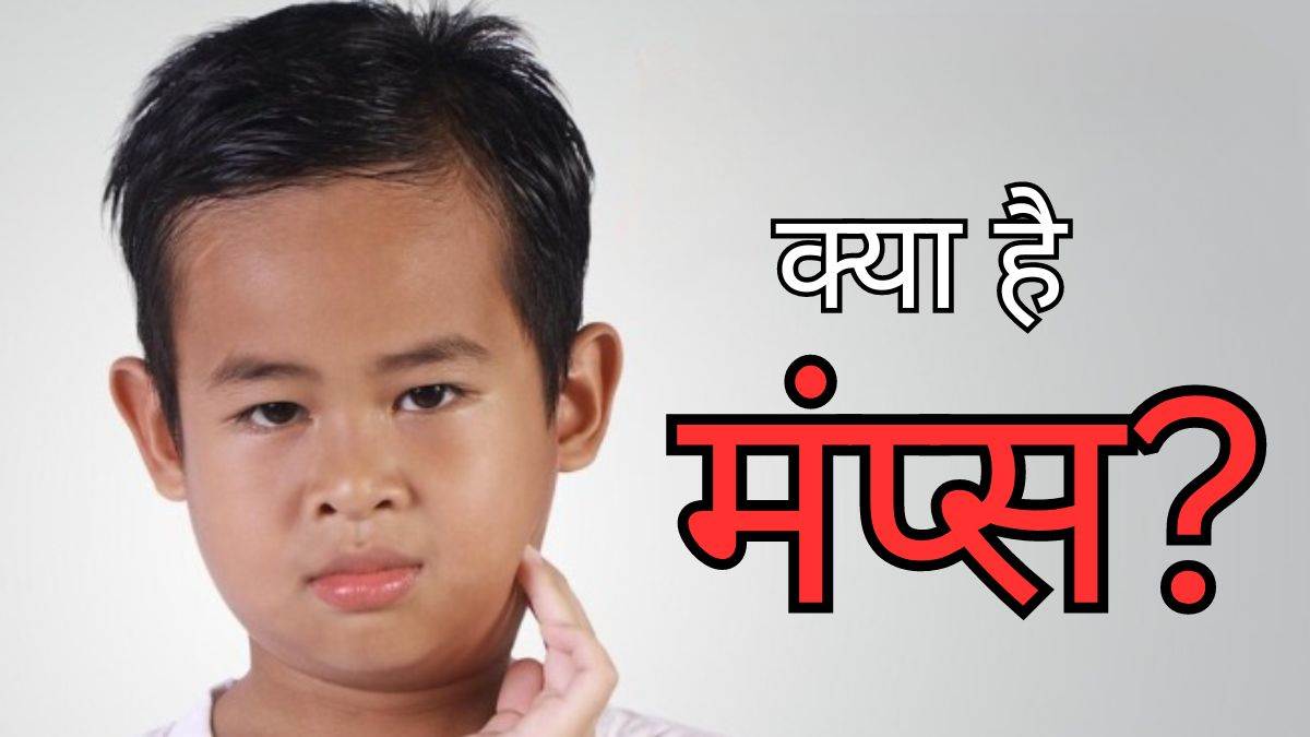 Mumps outbreak in Mumbai क्या है मंप्स जिसके मुंबई में तेजी से बढ़ रहे
