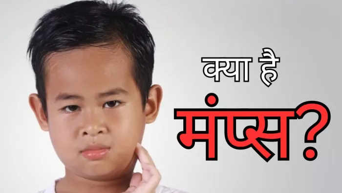 क्या है मंप्स, जिसके मुंबई में बढ़ रहे मामले
